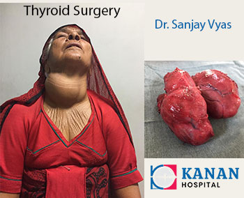 Breast-Thyroid-Surgery-Expert-in-Ahmedabad-DrSanjayVyas