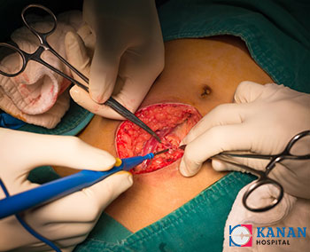 GI-Surgery-ahmedabad-drsanjayvyas-usmanpura-ahmedabad